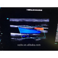 Carro de gama alta tipo Doppler color 4d con sonda de volumen